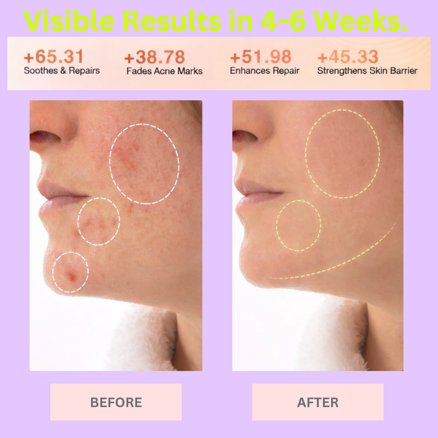 Pep! Skin Reset LED Mask